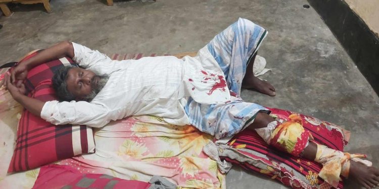 ইউনিয়ন পরিষদ কার্যালয়ে ঢুকে চেয়ারম্যানের পা ভেঙ্গে দিলো দুর্বৃত্তরা